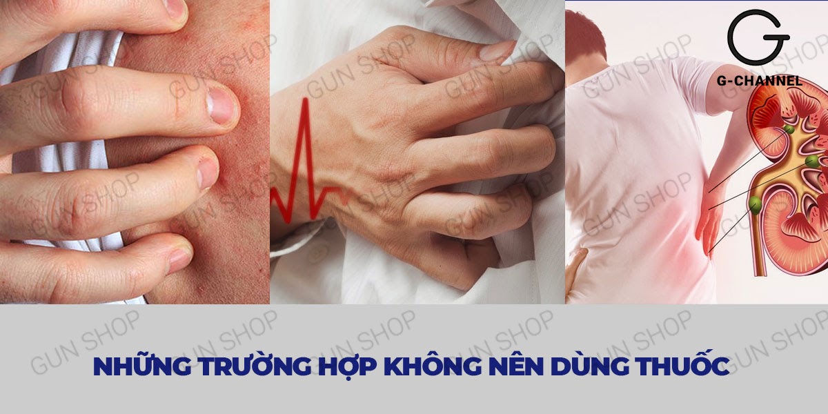  So sánh Azodra 50mg viên uống hỗ trợ cương dương kéo dài thời gian tăng cường sinh lý - Hộp 4 viên giá tốt